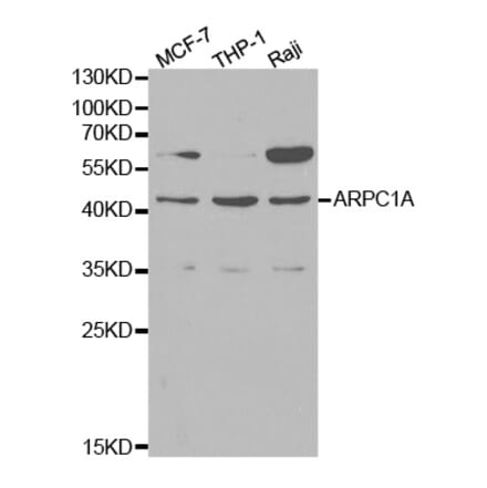 Western blot - ARPC1A Antibody from Signalway Antibody (32144) - Antibodies.com