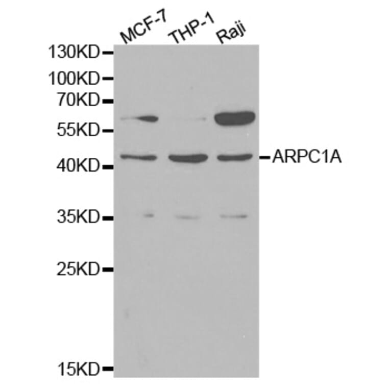 Western blot - ARPC1A Antibody from Signalway Antibody (32144) - Antibodies.com