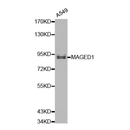 Western blot - MAGED1 Antibody from Signalway Antibody (32153) - Antibodies.com