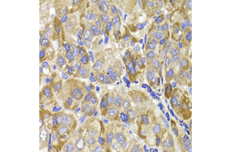 Immunohistochemistry - MAGED1 Antibody from Signalway Antibody (32153) - Antibodies.com