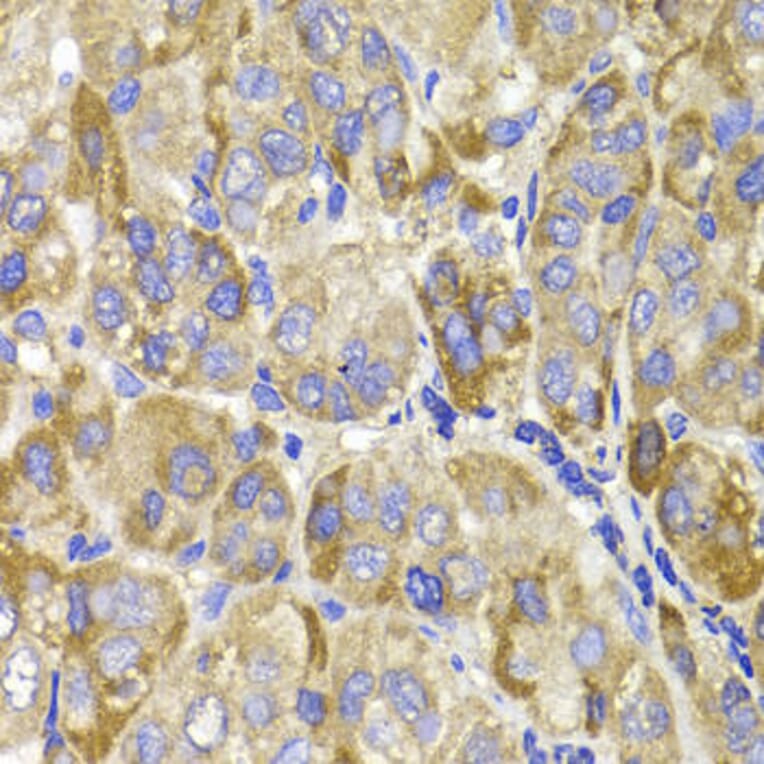 Immunohistochemistry - MAGED1 Antibody from Signalway Antibody (32153) - Antibodies.com