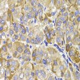 Immunohistochemistry - MAGED1 Antibody from Signalway Antibody (32153) - Antibodies.com