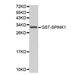 Western blot - SPINK1 Antibody from Signalway Antibody (32156) - Antibodies.com