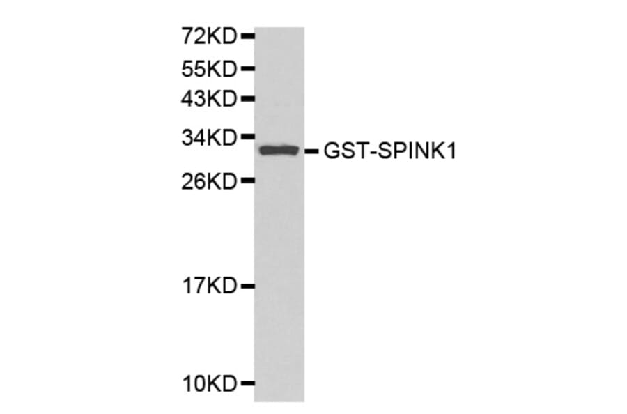 Western blot - SPINK1 Antibody from Signalway Antibody (32156) - Antibodies.com