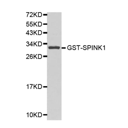Western blot - SPINK1 Antibody from Signalway Antibody (32156) - Antibodies.com