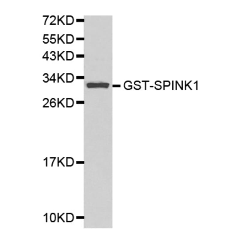 Western blot - SPINK1 Antibody from Signalway Antibody (32156) - Antibodies.com