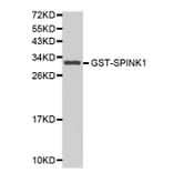 Western blot - SPINK1 Antibody from Signalway Antibody (32156) - Antibodies.com