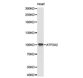 Western blot - ATP2A2 Antibody from Signalway Antibody (32157) - Antibodies.com