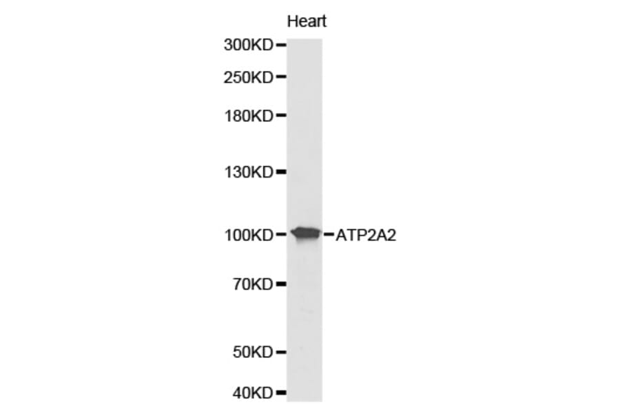 Western blot - ATP2A2 Antibody from Signalway Antibody (32157) - Antibodies.com