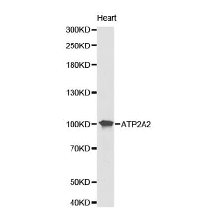 Western blot - ATP2A2 Antibody from Signalway Antibody (32157) - Antibodies.com