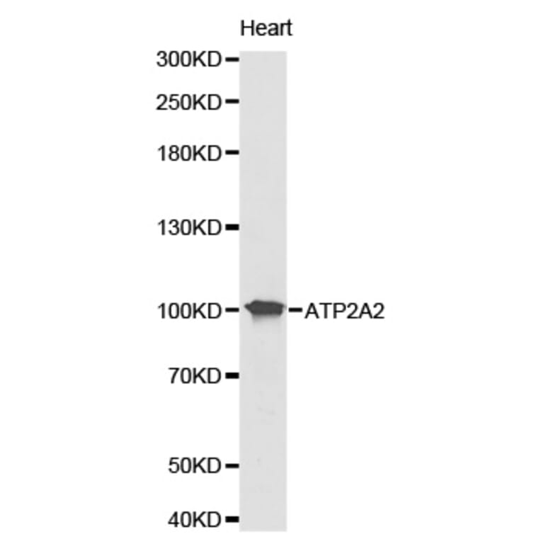 Western blot - ATP2A2 Antibody from Signalway Antibody (32157) - Antibodies.com