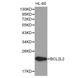 Western blot - BCL2L2 Antibody from Signalway Antibody (32190) - Antibodies.com