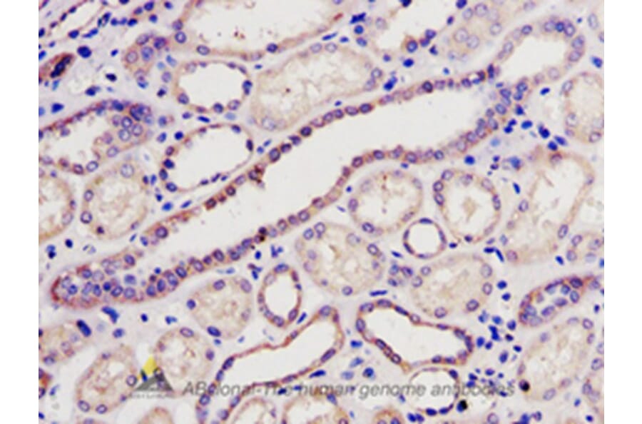 Immunohistochemistry - BCL2L2 Antibody from Signalway Antibody (32190) - Antibodies.com