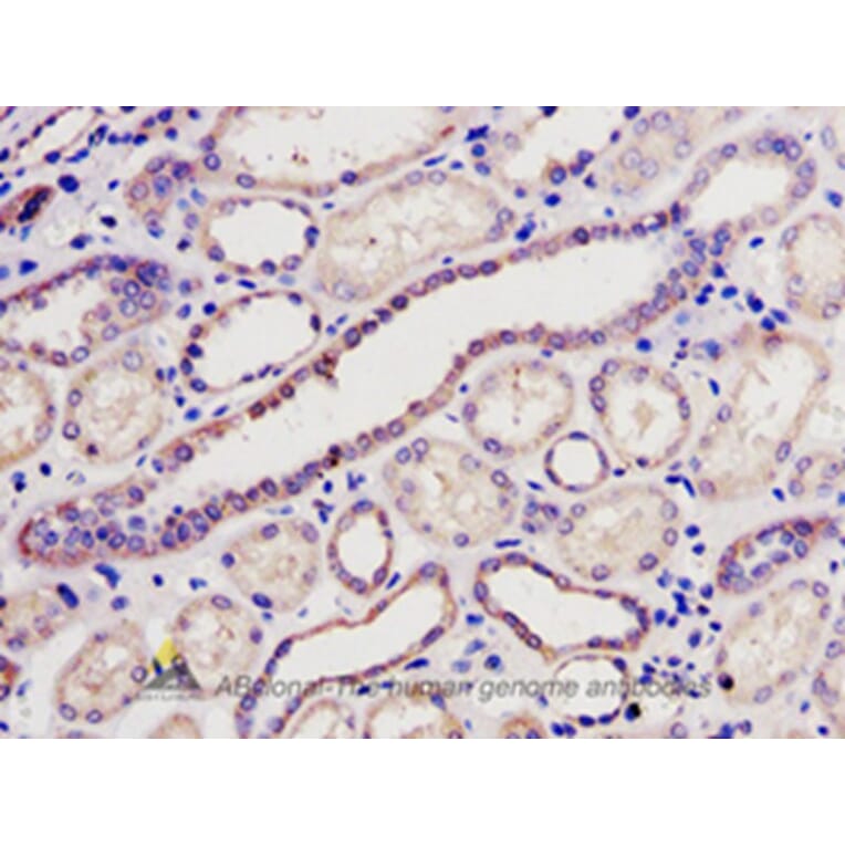 Immunohistochemistry - BCL2L2 Antibody from Signalway Antibody (32190) - Antibodies.com