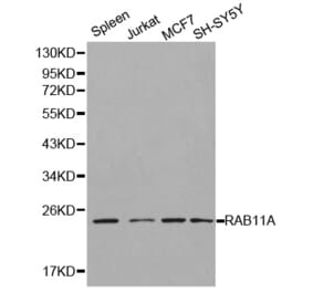 Western blot - RAB11A Antibody from Signalway Antibody (32197) - Antibodies.com