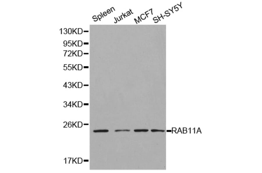 Western blot - RAB11A Antibody from Signalway Antibody (32197) - Antibodies.com