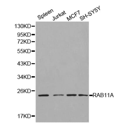 Western blot - RAB11A Antibody from Signalway Antibody (32197) - Antibodies.com