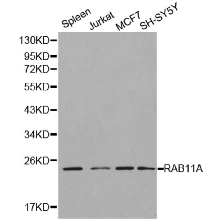 Western blot - RAB11A Antibody from Signalway Antibody (32197) - Antibodies.com