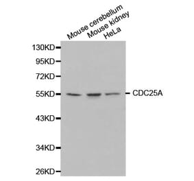 Western blot - CDC25A Antibody from Signalway Antibody (32202) - Antibodies.com