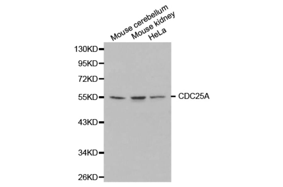 Western blot - CDC25A Antibody from Signalway Antibody (32202) - Antibodies.com