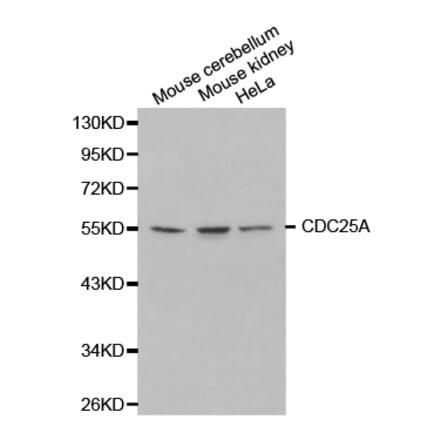 Western blot - CDC25A Antibody from Signalway Antibody (32202) - Antibodies.com