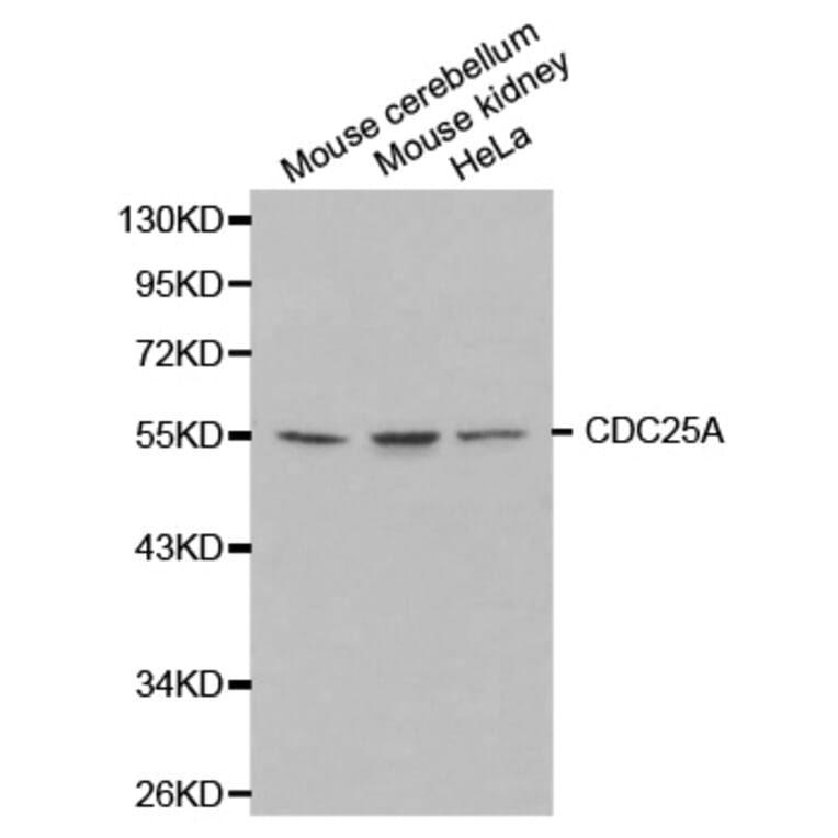 Western blot - CDC25A Antibody from Signalway Antibody (32202) - Antibodies.com