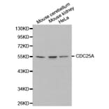 Western blot - CDC25A Antibody from Signalway Antibody (32202) - Antibodies.com