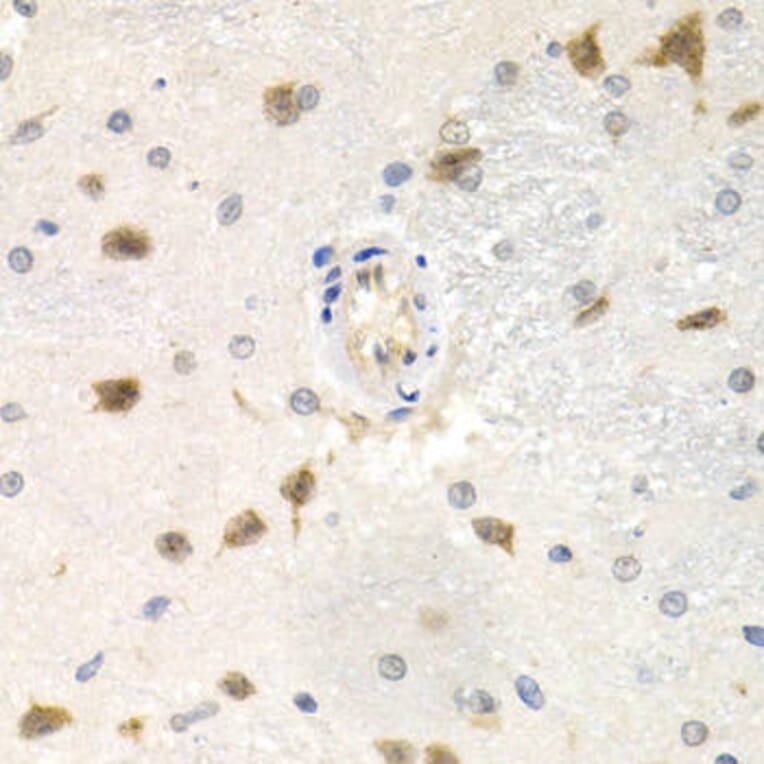 Immunohistochemistry - CDC25A Antibody from Signalway Antibody (32202) - Antibodies.com