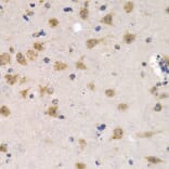 Immunohistochemistry - CDC25A Antibody from Signalway Antibody (32202) - Antibodies.com