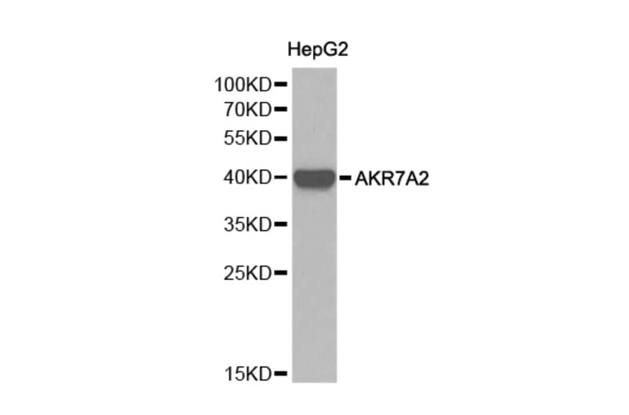 Western blot - AKR7A2 Antibody from Signalway Antibody (32242) - Antibodies.com