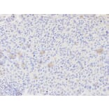 Immunohistochemistry - AKR7A2 Antibody from Signalway Antibody (32242) - Antibodies.com