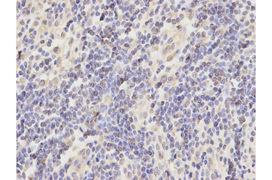 Immunohistochemistry - AKR7A2 Antibody from Signalway Antibody (32242) - Antibodies.com