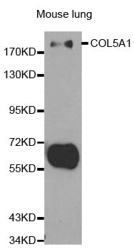 Western blot analysis of extracts of mouse lung cell line, using COL5A1 antibody.