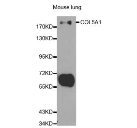 Western blot - COL5A1 Antibody from Signalway Antibody (32292) - Antibodies.com