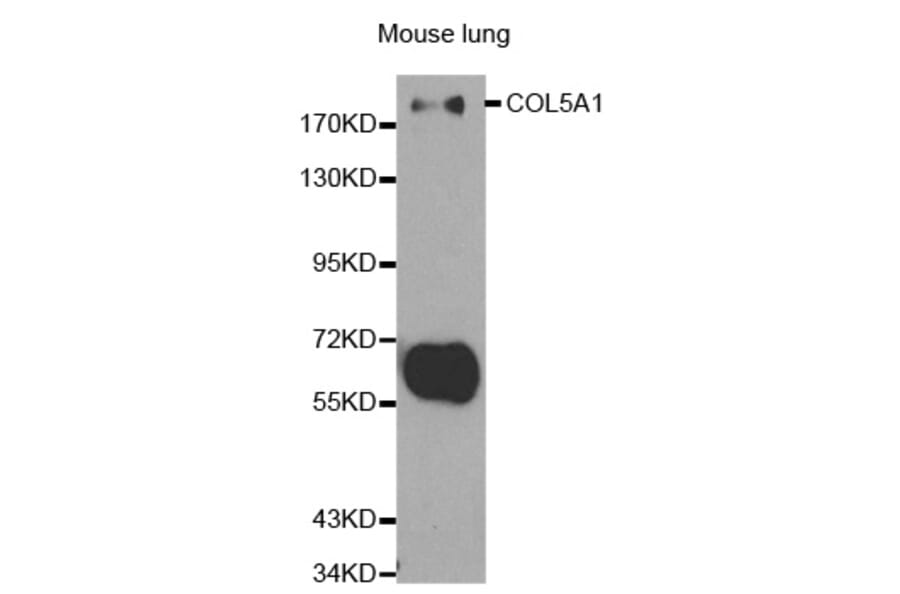 Western blot - COL5A1 Antibody from Signalway Antibody (32292) - Antibodies.com
