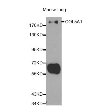 Western blot - COL5A1 Antibody from Signalway Antibody (32292) - Antibodies.com