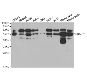 Western blot - SCARB1 Antibody from Signalway Antibody (32326) - Antibodies.com