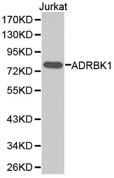 Western blot analysis of extracts of Jurkat cell lines, using ADRBK1 antibody.