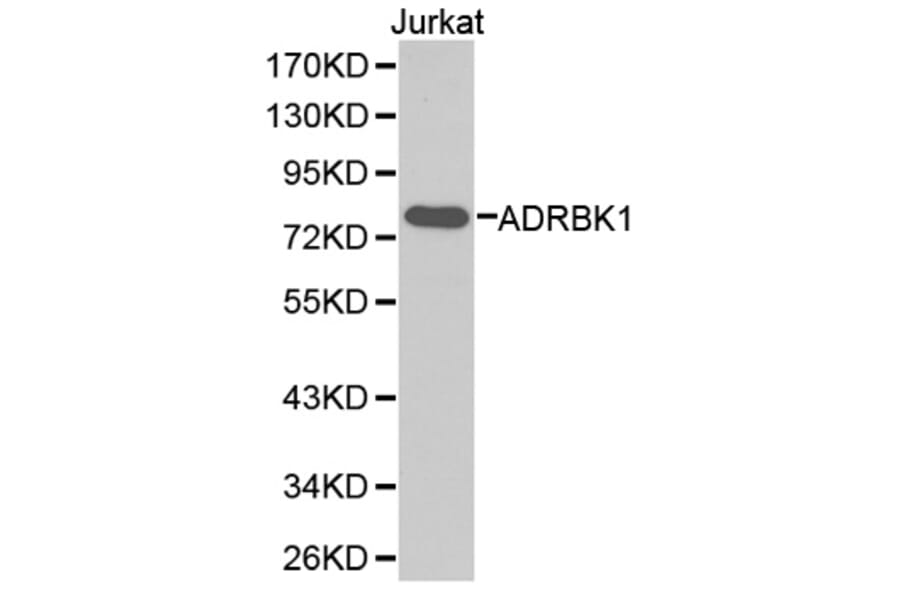 Western blot - ADRBK1 Antibody from Signalway Antibody (32373) - Antibodies.com