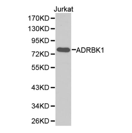 Western blot - ADRBK1 Antibody from Signalway Antibody (32373) - Antibodies.com