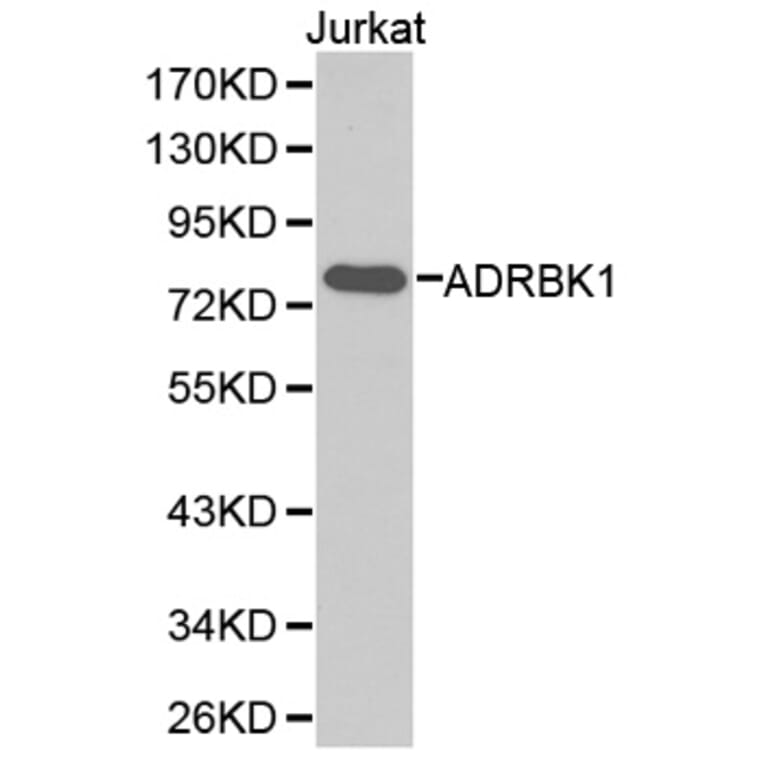 Western blot - ADRBK1 Antibody from Signalway Antibody (32373) - Antibodies.com