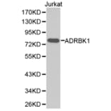 Western blot - ADRBK1 Antibody from Signalway Antibody (32373) - Antibodies.com