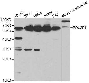 Western blot analysis of extracts of various cell lines, using POU2F1 antibody.