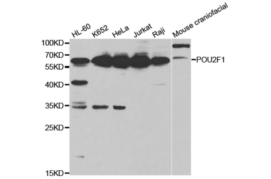 Western blot - POU2F1 Antibody from Signalway Antibody (32384) - Antibodies.com