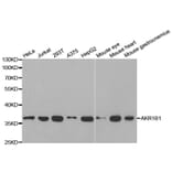 Western blot - AKR1B1 Antibody from Signalway Antibody (32385) - Antibodies.com