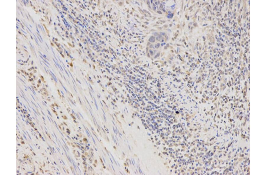 Immunohistochemistry - AKR1B1 Antibody from Signalway Antibody (32385) - Antibodies.com