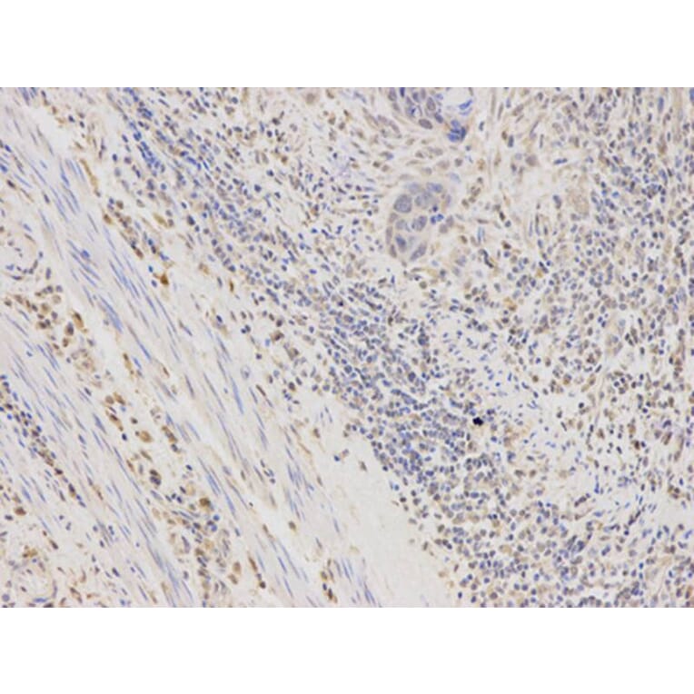 Immunohistochemistry - AKR1B1 Antibody from Signalway Antibody (32385) - Antibodies.com