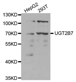 Western blot analysis of extracts of various cell lines, using µgT2B7 antibody.