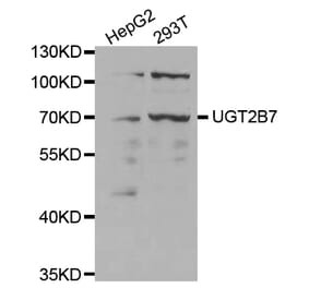 Western blot - UGT2B7 Antibody from Signalway Antibody (32390) - Antibodies.com