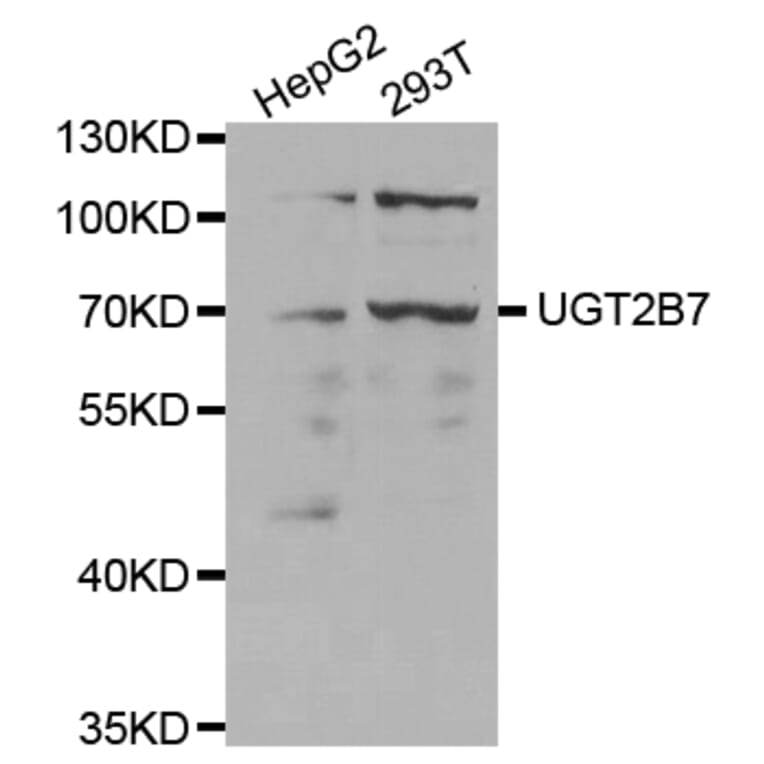 Western blot - UGT2B7 Antibody from Signalway Antibody (32390) - Antibodies.com
